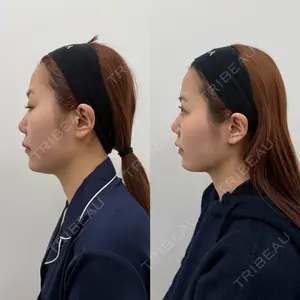 Next Tokyo Clinic 松本 俊太郎医師の症例