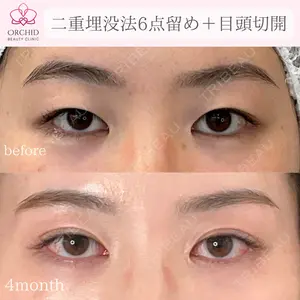 オーキッド美容クリニック東京御徒町 西浦 蘭子医師の症例