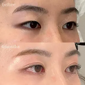 オーキッド美容クリニック東京御徒町 西浦 蘭子医師の症例