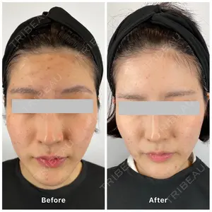 oneUPclinicの症例