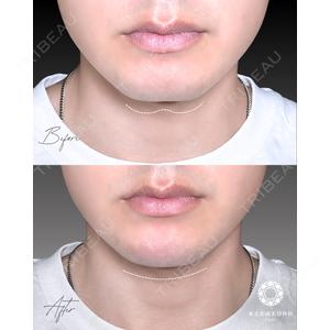 東京形成美容外科 船橋院 山崎 修吾医師の症例