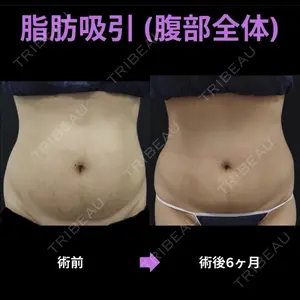 下北沢スキンクリニックの症例