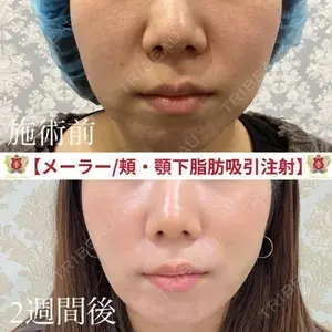 シャトークリニック 河合 秀紀医師の症例