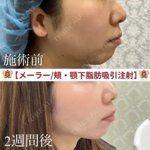 シャトークリニック 河合 秀紀医師の症例