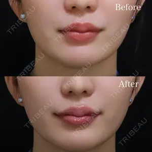 Wクリニック 福岡院 堂園 史子医師の症例