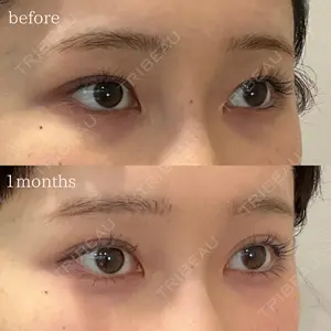 オーキッド美容クリニック東京御徒町 西浦 蘭子医師の症例