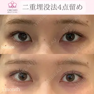 オーキッド美容クリニック東京御徒町 西浦 蘭子医師の症例