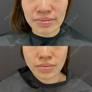 LA MER CLINIC 辻 航平医師の症例