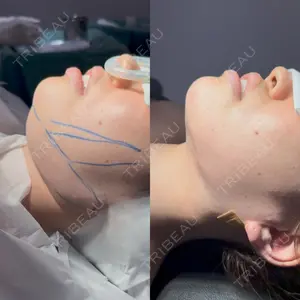 LA MER CLINIC 辻 航平医師の症例
