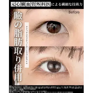 湘南美容クリニック 大阪梅田本院 横谷 仁彦医師の症例