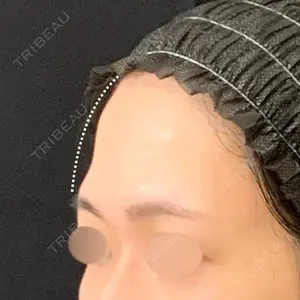 アメリクリニック福岡の症例