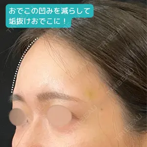 アメリクリニック福岡の症例