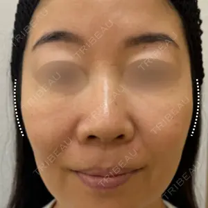 アメリクリニック福岡の症例