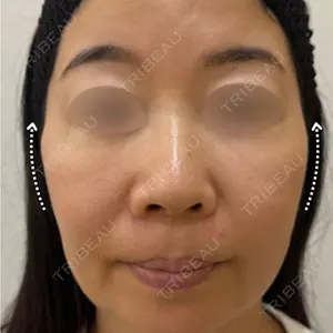 アメリクリニック福岡の症例