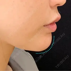 アメリクリニック福岡の症例