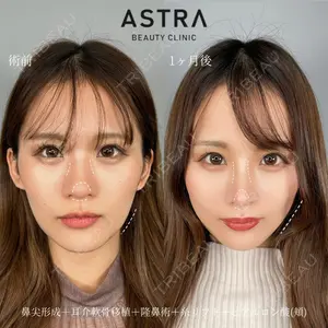 ASTRA BEAUTY CLINIC 塩満 惠子医師の症例