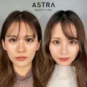 ASTRA BEAUTY CLINIC 塩満 惠子医師の症例