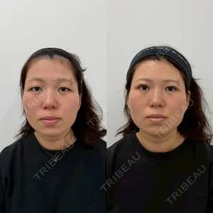 Next Tokyo Clinic 松本 俊太郎医師の症例