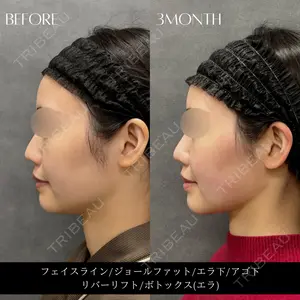 RIVER CLINIC（リバークリニック）大阪院 木家 佑理子医師の症例