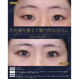 聖心美容クリニック 広島院 中辻 隆徳医師の症例