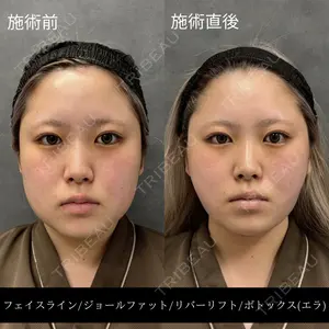 RIVER CLINIC（リバークリニック）大阪院 木家 佑理子医師の症例