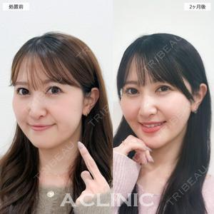 A CLINIC（エークリニック） 新宿院 瀬戸　翔太医師の症例