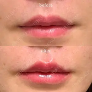 Wクリニック 福岡院 堂園 史子医師の症例