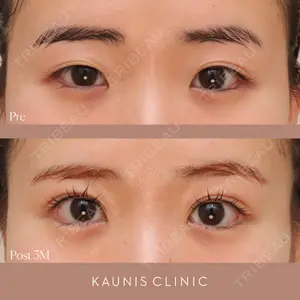 KAUNIS CLINIC（カウニスクリニック） 高野 敏郎医師の症例