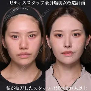 Zetith Beauty Clinic 銀座院 鉄 鑠医師の症例