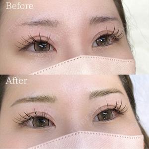 NARU Beauty Clinic 【ナルクリ】の症例