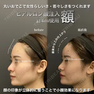 ロレシー美容クリニック 心斎橋駅前院 福留院長医師の症例