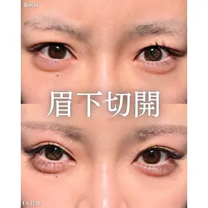 新宿美容外科ネビュラクリニック 山本 紘子医師の症例