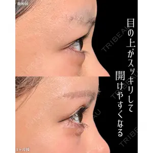 新宿美容外科ネビュラクリニック 山本 紘子医師の症例