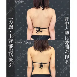EMMO FACE CLINIC 大阪梅田院 神谷 一成医師の症例
