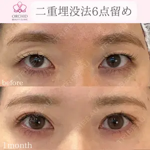 オーキッド美容クリニック東京御徒町 西浦 蘭子医師の症例