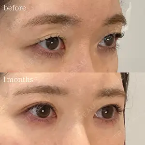 オーキッド美容クリニック東京御徒町 西浦 蘭子医師の症例