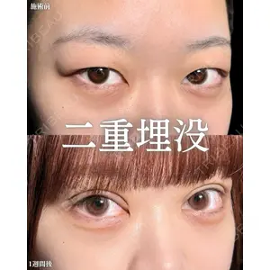 新宿美容外科ネビュラクリニック 山本 紘子医師の症例