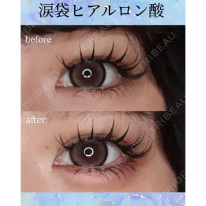 千葉美容外科アイビークリニック 藤田 愛樹医師の症例