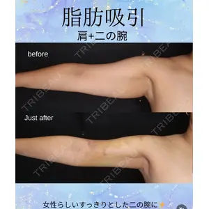 千葉美容外科アイビークリニック 藤田 愛樹医師の症例