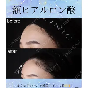 千葉美容外科アイビークリニック 藤田 愛樹医師の症例