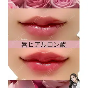 吉祥寺アイビークリニック 巴 窓花医師の症例