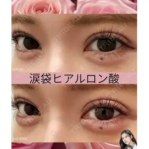 吉祥寺アイビークリニック 巴 窓花医師の症例