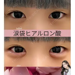 吉祥寺アイビークリニック 巴 窓花医師の症例