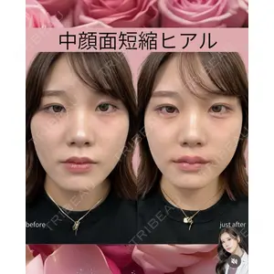 吉祥寺アイビークリニック 巴 窓花医師の症例