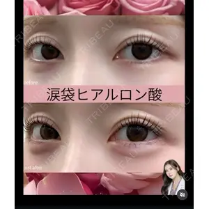 吉祥寺アイビークリニック 巴 窓花医師の症例