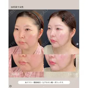 自由が丘ウェルエイジングビューティークリニック 福田 知佐子医師の症例