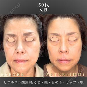 BiBiクリニック 山本 幸一郎医師の症例