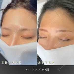BiBiクリニックの症例
