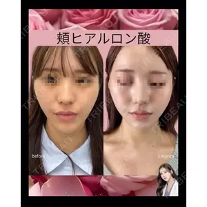 吉祥寺アイビークリニック 巴 窓花医師の症例