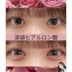 吉祥寺アイビークリニック 巴 窓花医師の症例